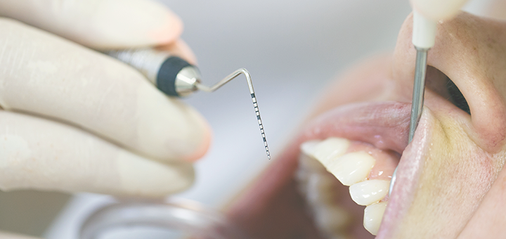 Falta de dentes pode causar dores de cabeças