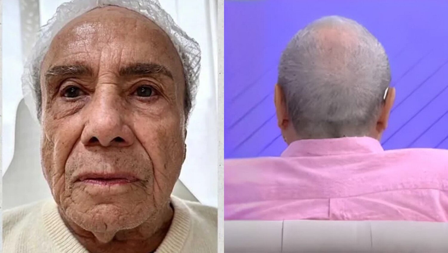 No SBT, Stênio Garcia surge irreconhecível após harmonização facial e vira piada na web; assista