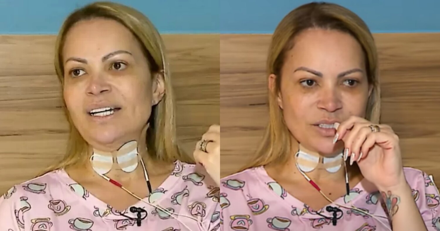 Em tratamento, Solange Almeida revela sequelas após uso de vape: 'Irreconhecível'