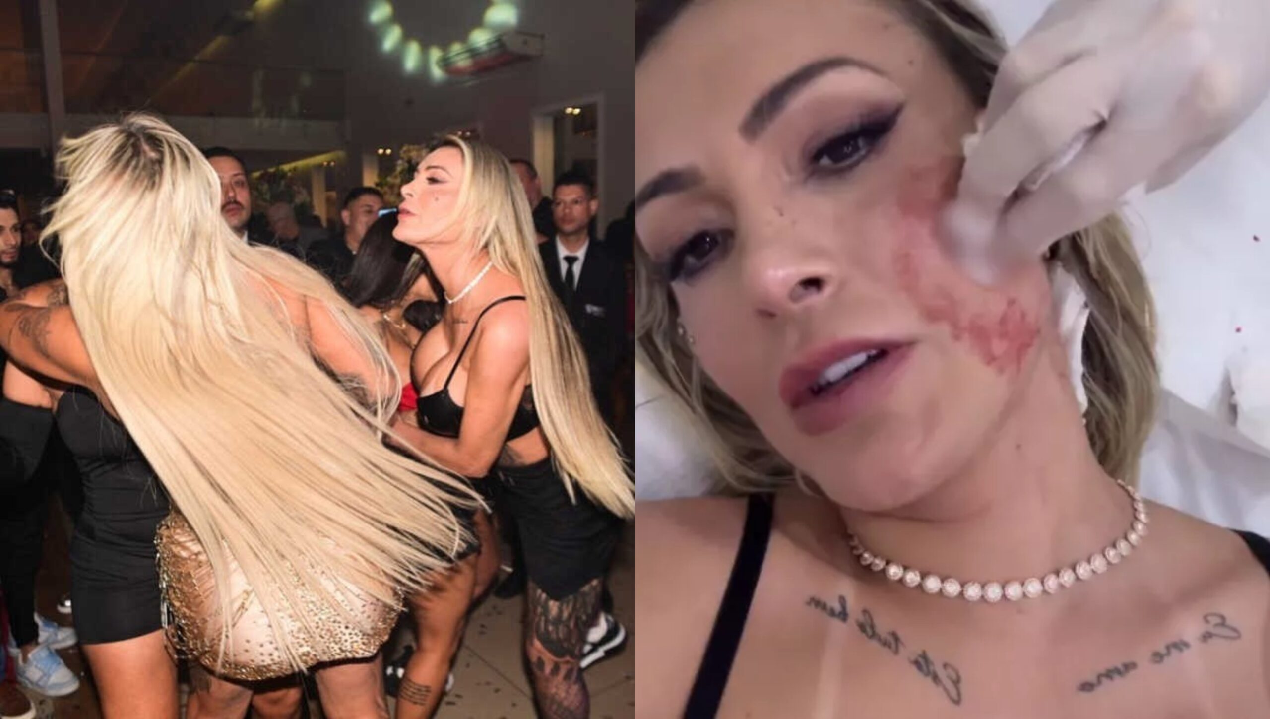 Em festa, Andressa Urach sai no tapa com Juju Ferrari e leva pontos no rosto; assista