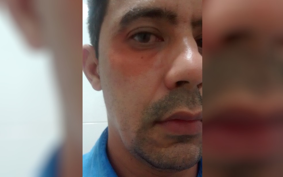 Porteiro é agredido após barrar entrada de mulheres em condomínio