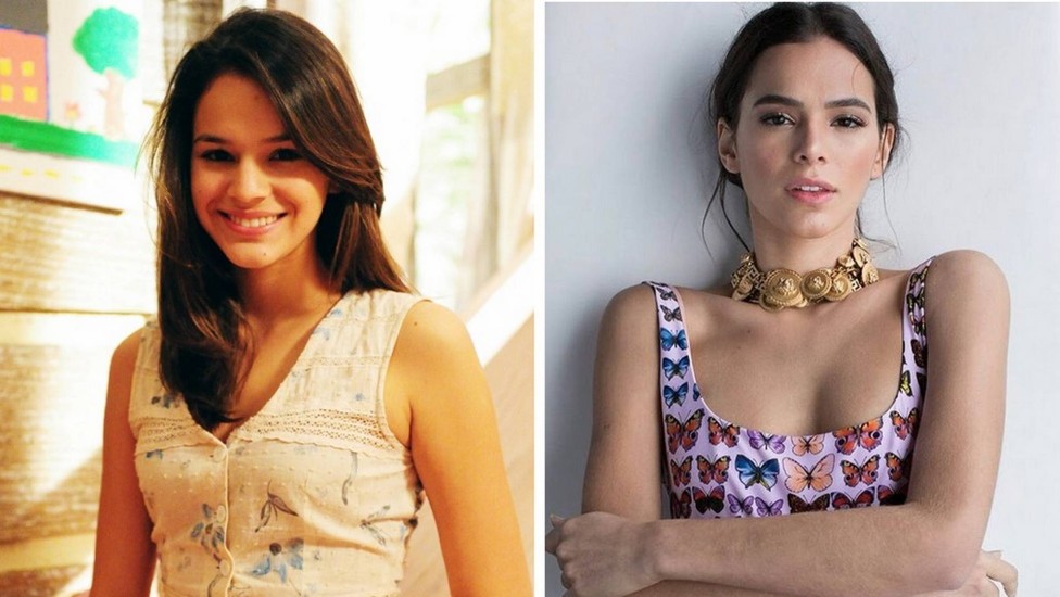 Bruna Marquezine admite plástica no nariz