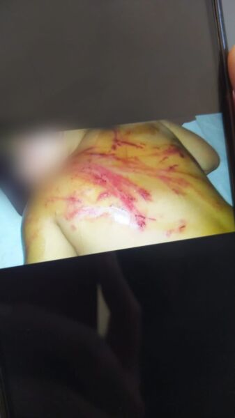 Jovem é presa suspeita de agredir a filha com vara, em Trindade