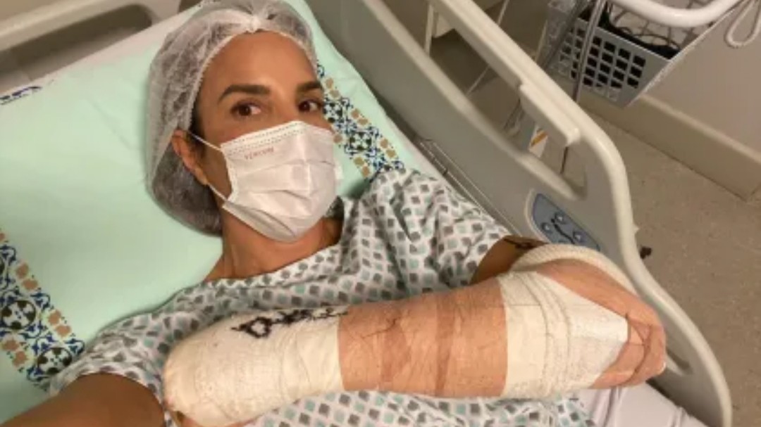 Após acidente com esqui, Ivete Sangalo passa por cirurgia no braço