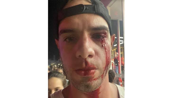 Rock in Rio: Fotógrafo é agredido após esbarrar em adolescente