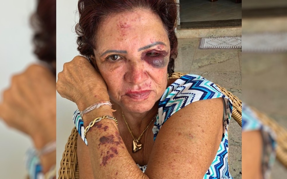 Suspeito de agredir e roubar ex-primeira-dama de Itaberaí é preso