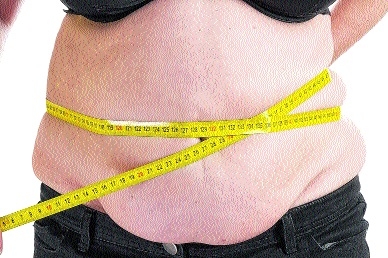 Liberação de cirurgia pode ajudar diminuir índice de obesidade