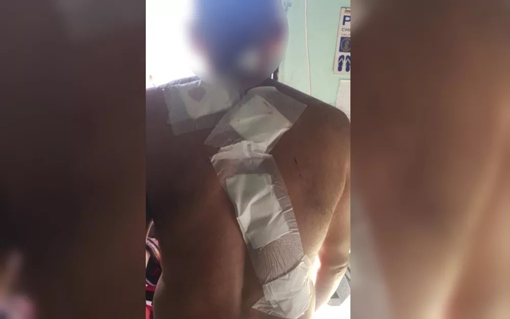 Homem é agredido por vizinhos após reclamar de som alto